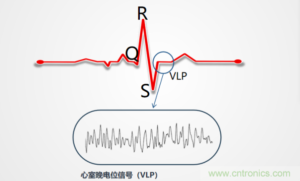 解決心電監(jiān)測行業(yè)難題,曼森伯格的濾波技術(shù)獲國家知識產(chǎn)權(quán)局發(fā)明授權(quán) 解決心電監(jiān)測行業(yè)難題,曼森伯格的濾波技術(shù)獲國家知識產(chǎn)權(quán)局發(fā)明授權(quán)